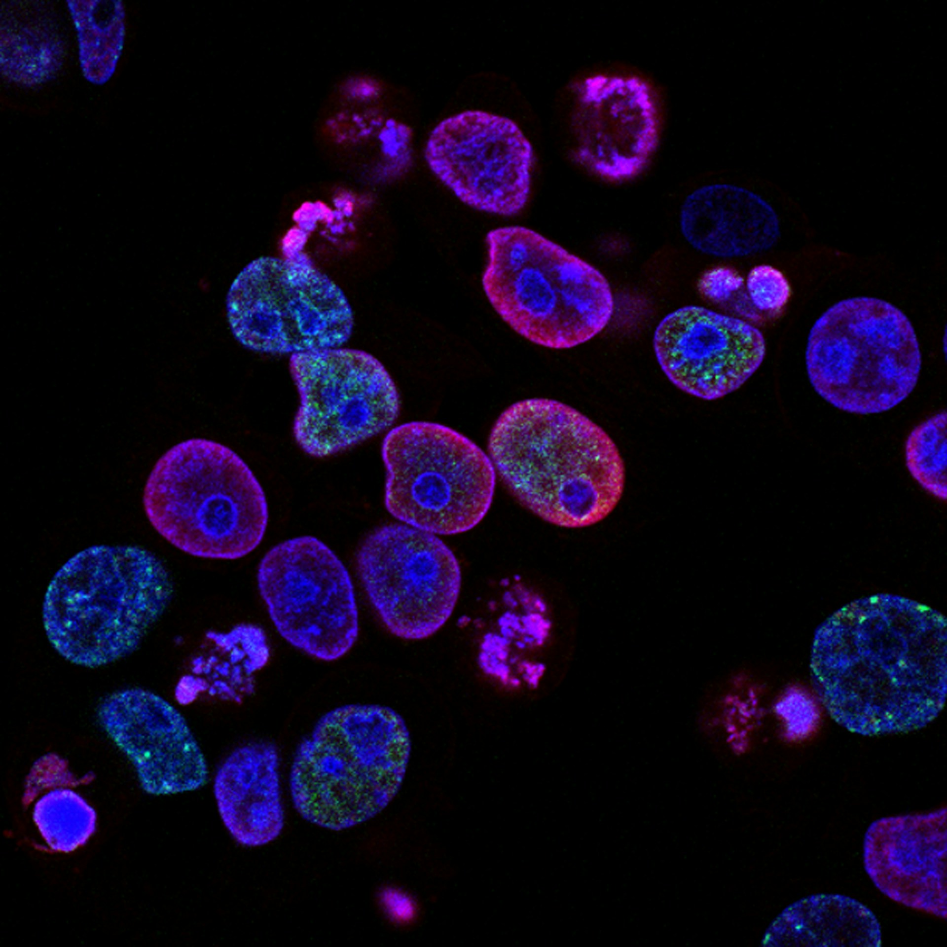 Fluorescent microscopy of cells